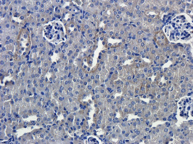 Interferon gamma Rabbit Polyclonal Antibody