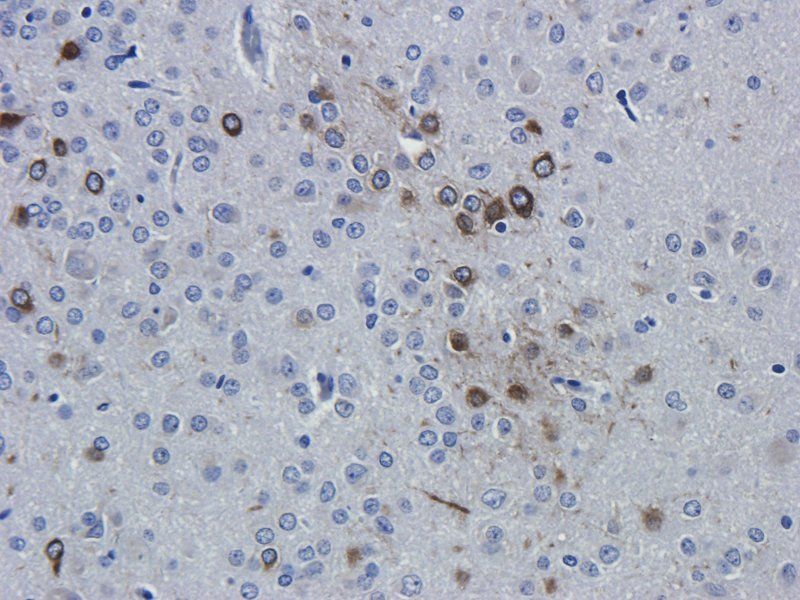 Interferon gamma Rabbit Polyclonal Antibody