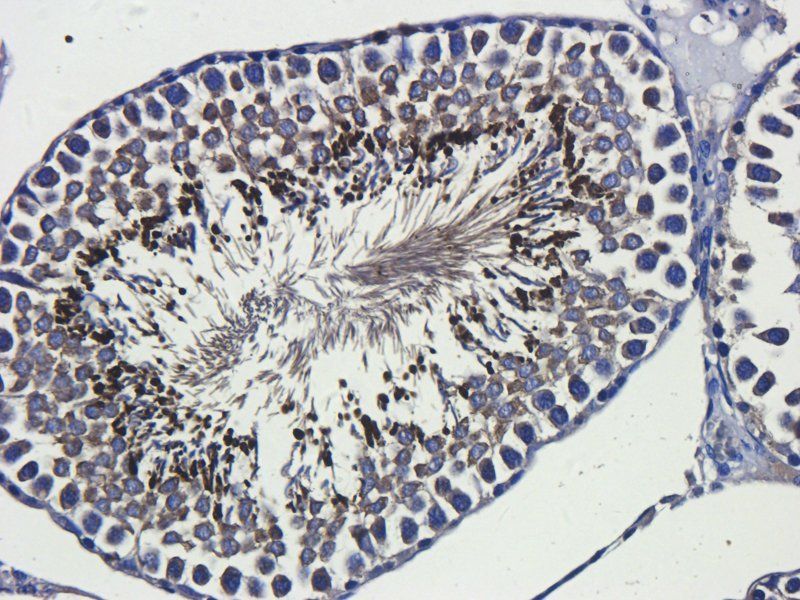 Interferon gamma Rabbit Polyclonal Antibody