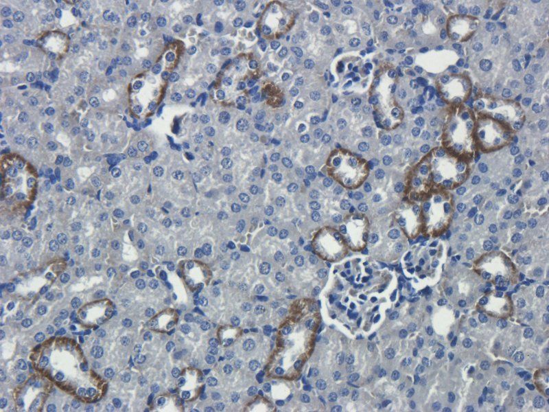 Interferon gamma Rabbit Polyclonal Antibody