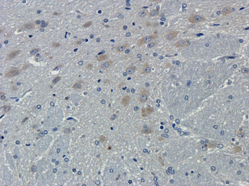 Interferon gamma Rabbit Polyclonal Antibody