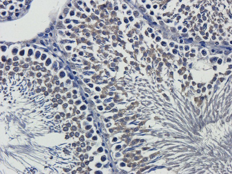 Interferon gamma Rabbit Polyclonal Antibody