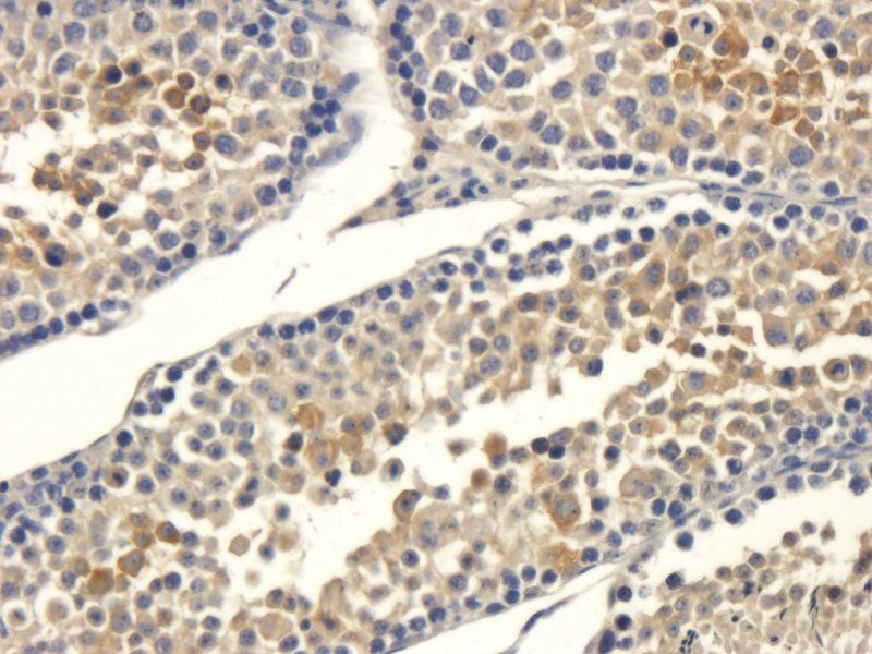 Interferon gamma Rabbit Polyclonal Antibody