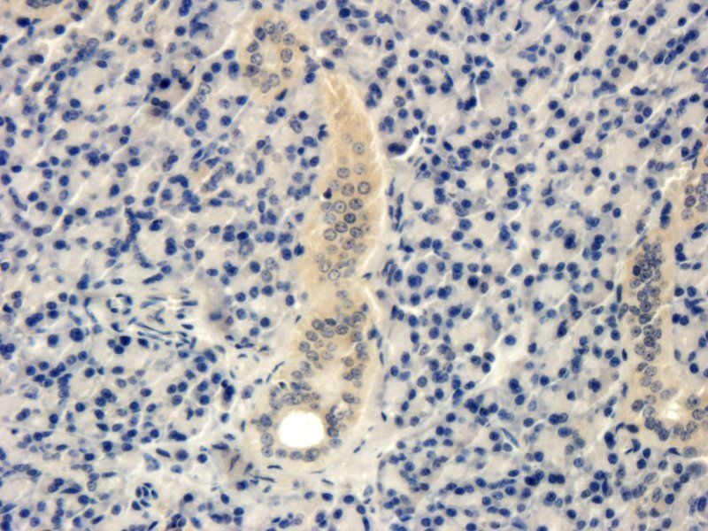 Interferon gamma Rabbit Polyclonal Antibody