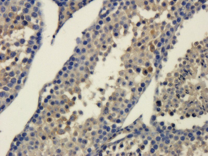 Interferon gamma Rabbit Polyclonal Antibody