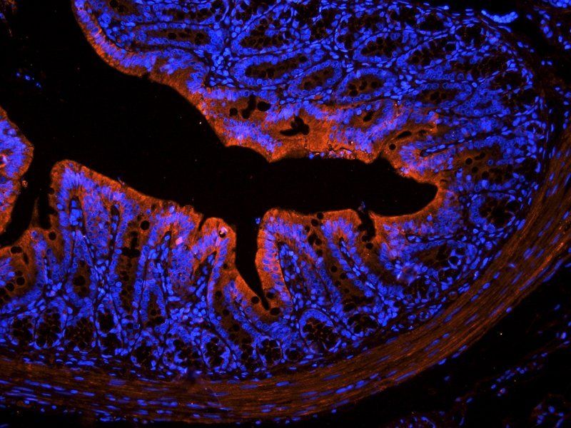 IGF1 Rabbit Polyclonal Antibody