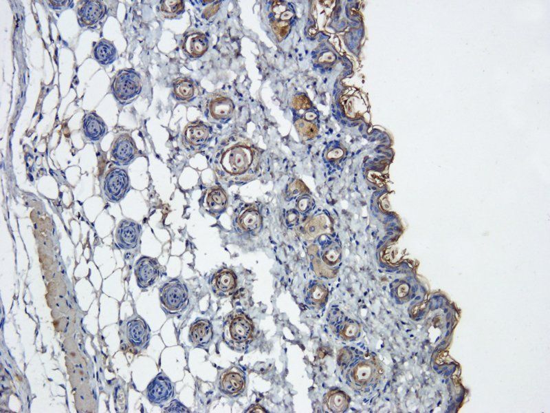 IGF1 Rabbit Polyclonal Antibody