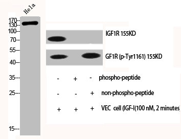 IGF1R/INSR Antibody