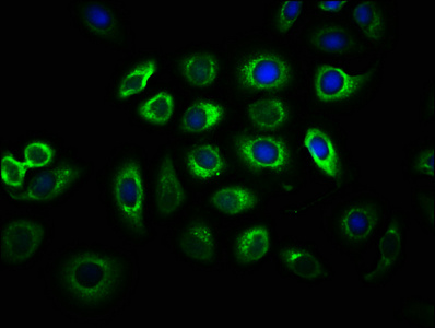 IGF2R Antibody