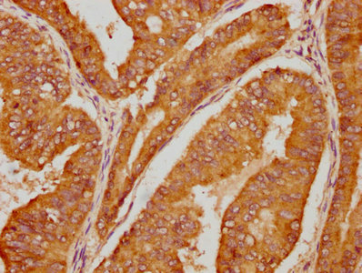 IGF2R Antibody