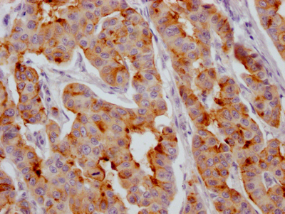 IGFBP2 Antibody