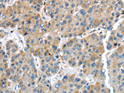 IGFBP4 Antibody
