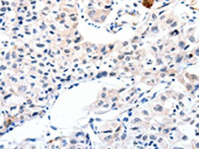 IGFBP7 Antibody