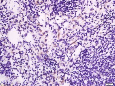 JCHAIN Rabbit Polyclonal Antibody