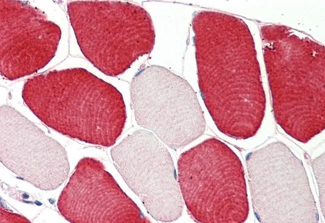 Goat anti-MIA / CD-RAP Antibody