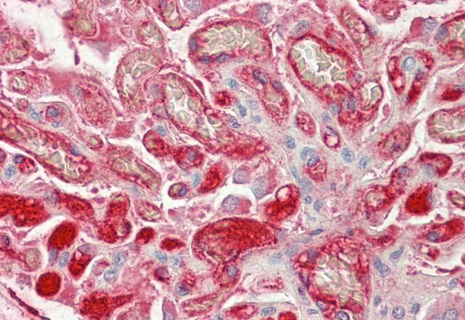 Fibrinogen Beta Chain (aa 177-190) Goat Polyclonal Antibody