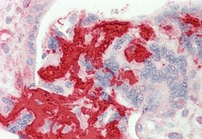 Fibrinogen Beta Chain (aa 177-190) Goat Polyclonal Antibody
