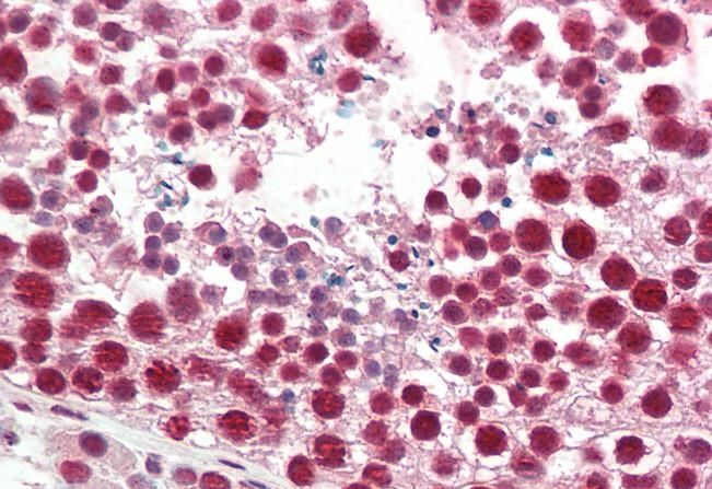 HNRNPA2B1 Antibody