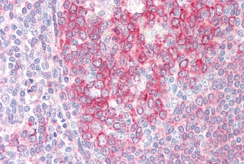 SWAP70 Antibody