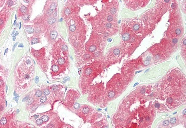 HDAC6 Antibody