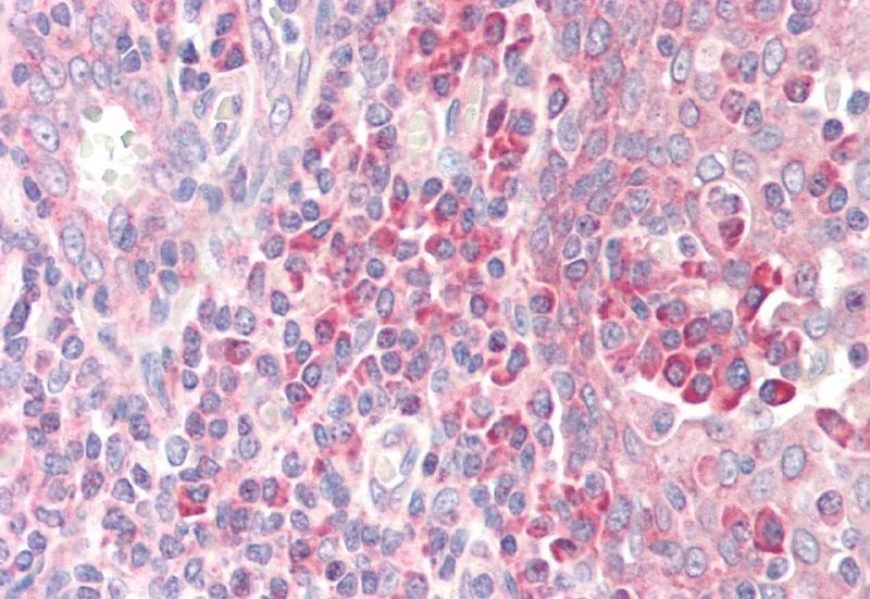 RPS19 Antibody