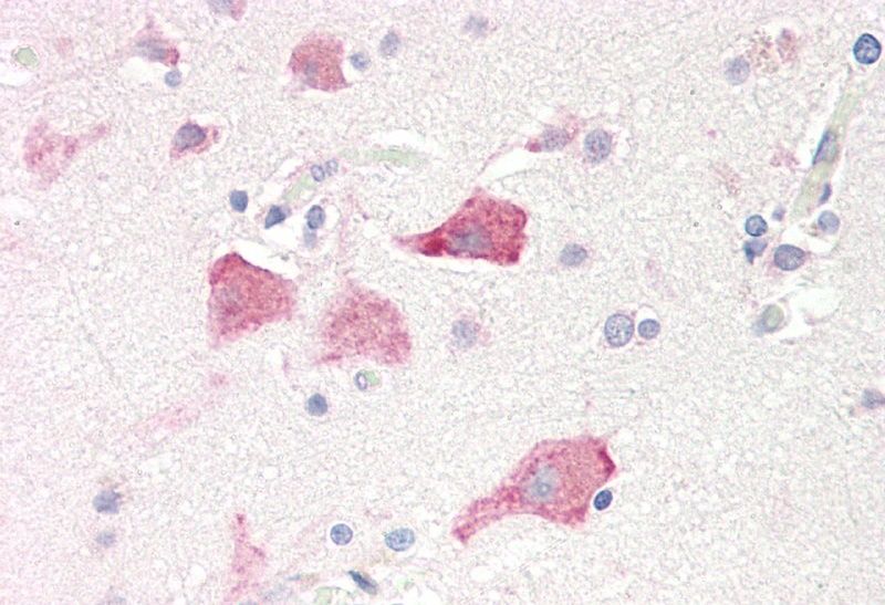 RPS19 Antibody