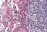 CSNK1E Antibody