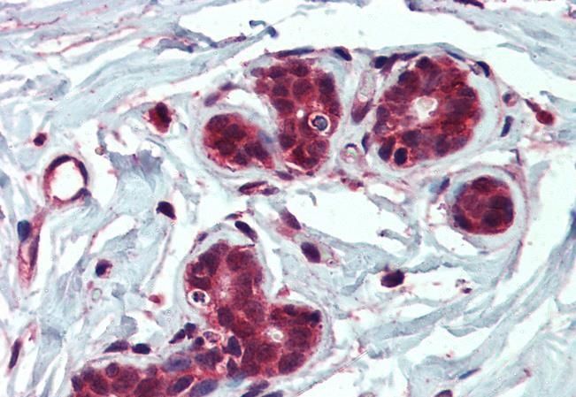 Insulysin/Insulinase Antibody