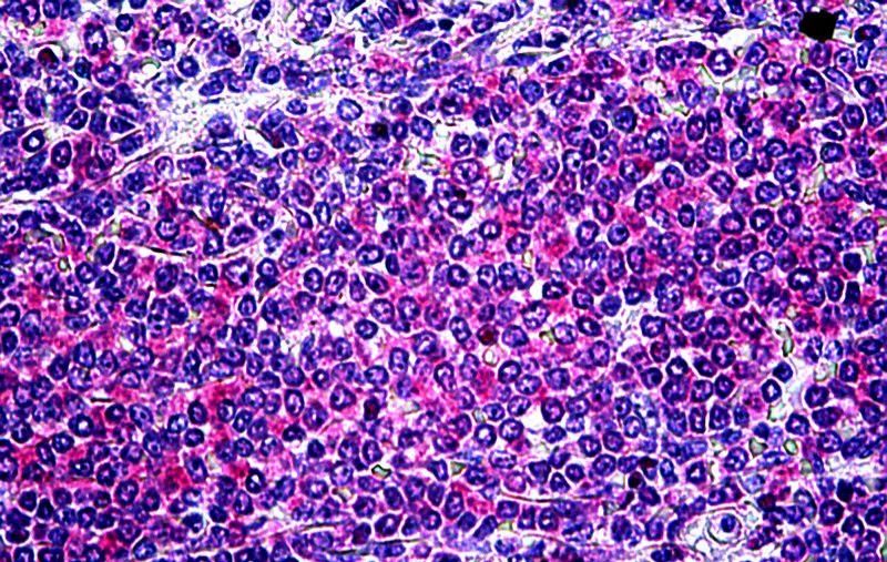 ITK Antibody