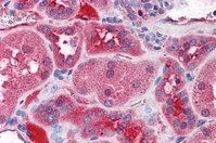KCNN2 Antibody