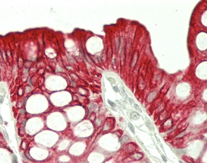 Mouse Cytokeratin 20 Antibody