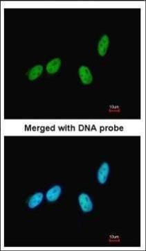 RED Rabbit Polyclonal Antibody