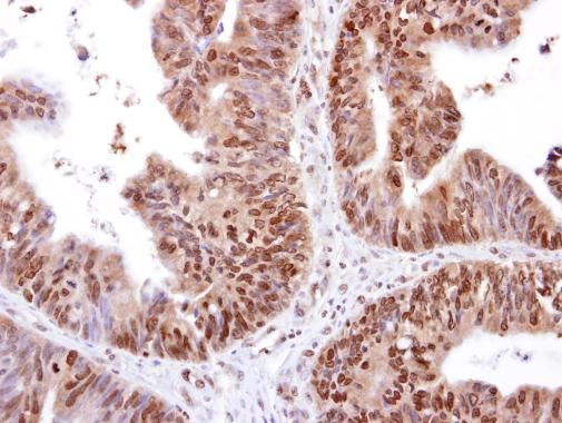RED Rabbit Polyclonal Antibody