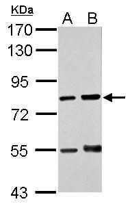 RED Rabbit Polyclonal Antibody