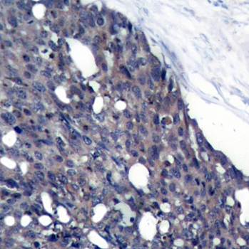 IkB-a Rabbit Polyclonal Antibody