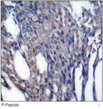 IkB-a (Phospho-Tyr42) Rabbit Polyclonal Antibody