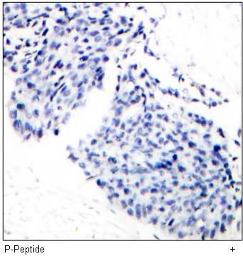 IkB-a (Phospho-Tyr42) Rabbit Polyclonal Antibody