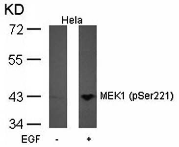 IkB-a (Phospho-Tyr42) Rabbit Polyclonal Antibody