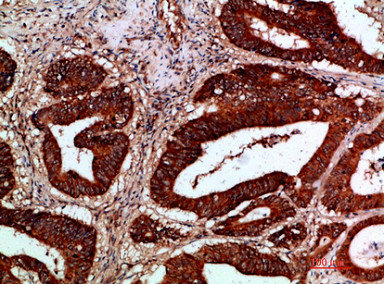 IKBKG Antibody