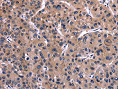 IL1A Antibody