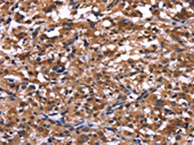 IL1A Antibody