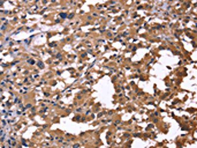 IL1A Antibody