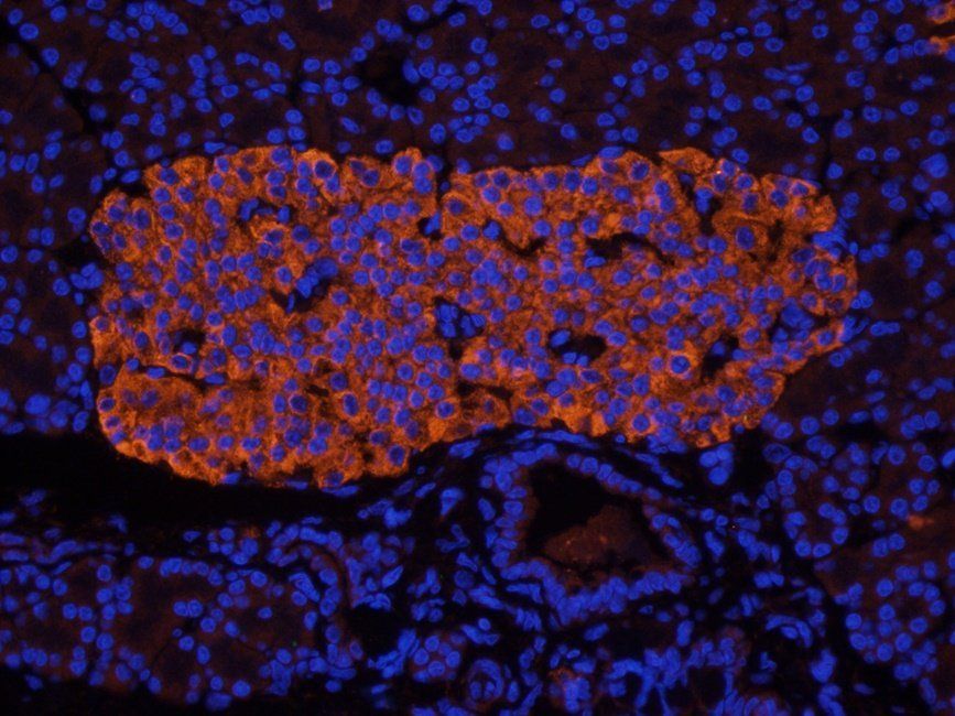 IL1 beta Rabbit Polyclonal Antibody