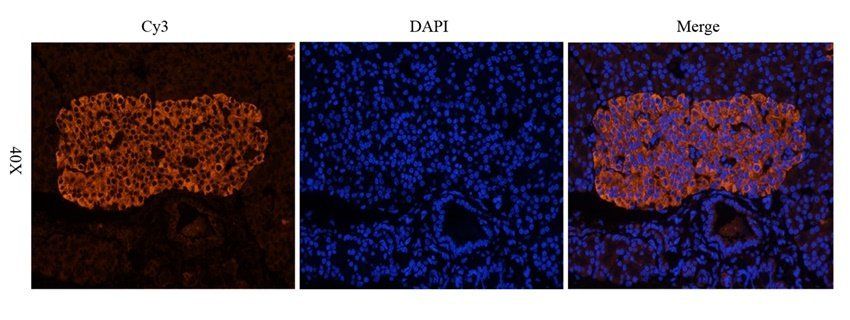 IL1 beta Rabbit Polyclonal Antibody