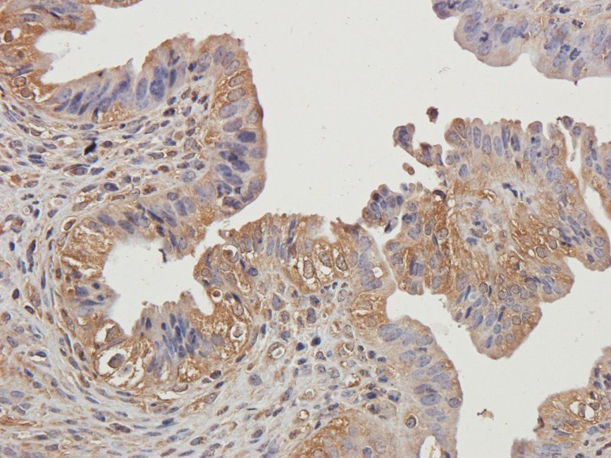 IL1 beta Rabbit Polyclonal Antibody