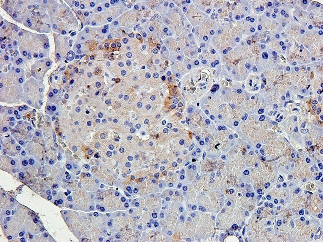 IL1 beta Rabbit Polyclonal Antibody