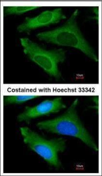 IL1 Receptor antagonist Rabbit Polyclonal Antibody