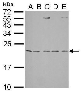 IL1 Receptor antagonist Rabbit Polyclonal Antibody