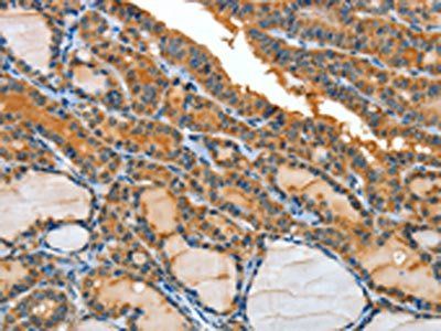 IL1R1 Antibody