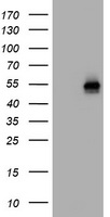 IL1R2 Antibody
